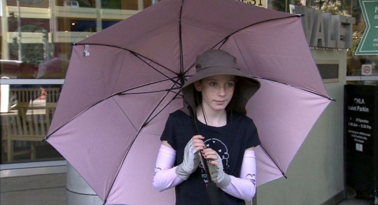 🌞 11-Year-Old Girl Battles Rare 'Sun Allergy' Condition That Keeps Her in the Shadows
